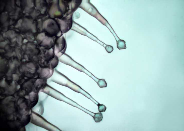 Mikrodlakava biljka pod mikroskopom